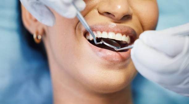 Best Walk-In Emergency Dental Services in Carleton, MI
